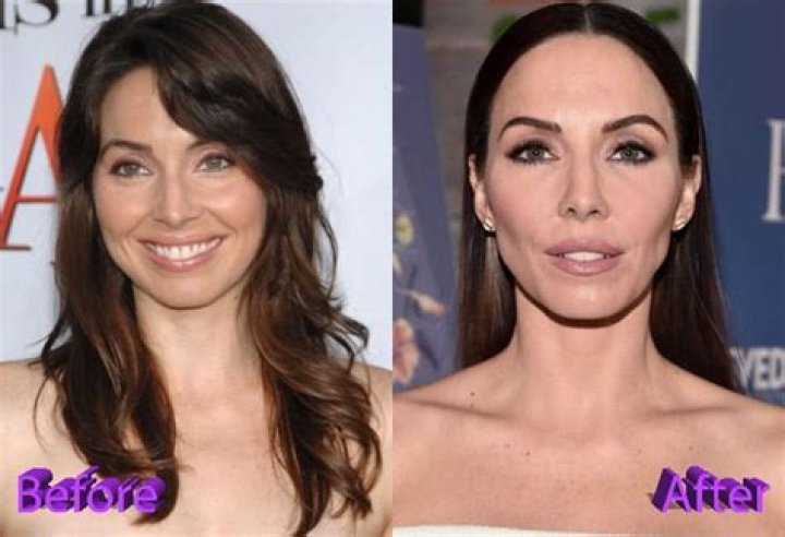 Whitney Cummings' Plastic Surgery Journey